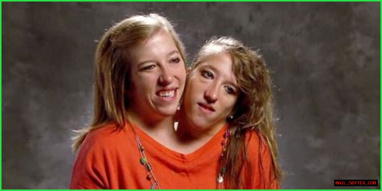 Abby And Brittany Hensel: The Remarkable Journey Of Conjoined Twins