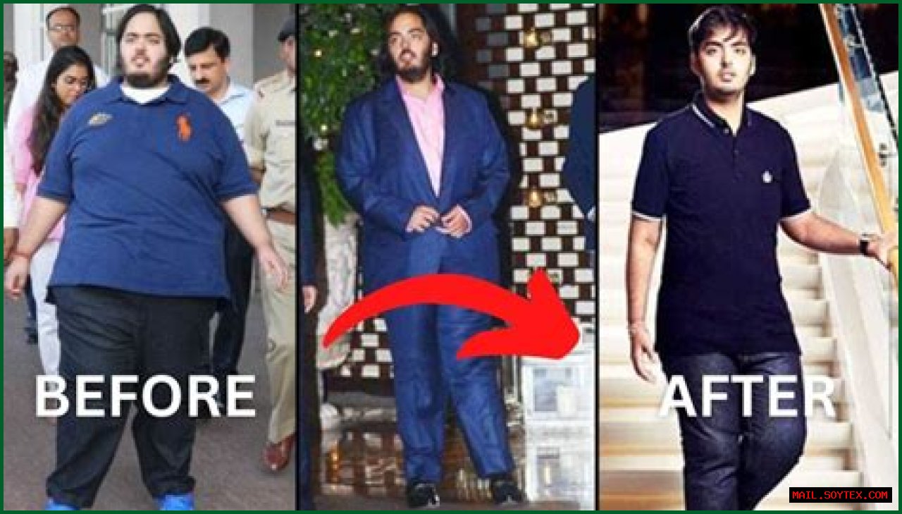 Anant Ambani's Health Journey: Is His Disease Curable Or Not?