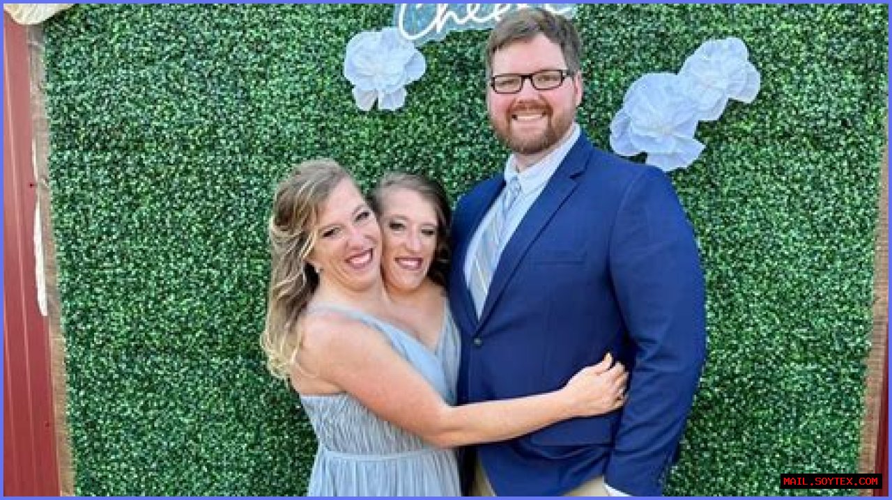 Understanding The Lives And Legacy Of Abby And Brittany Hensel: Conjoined Twins